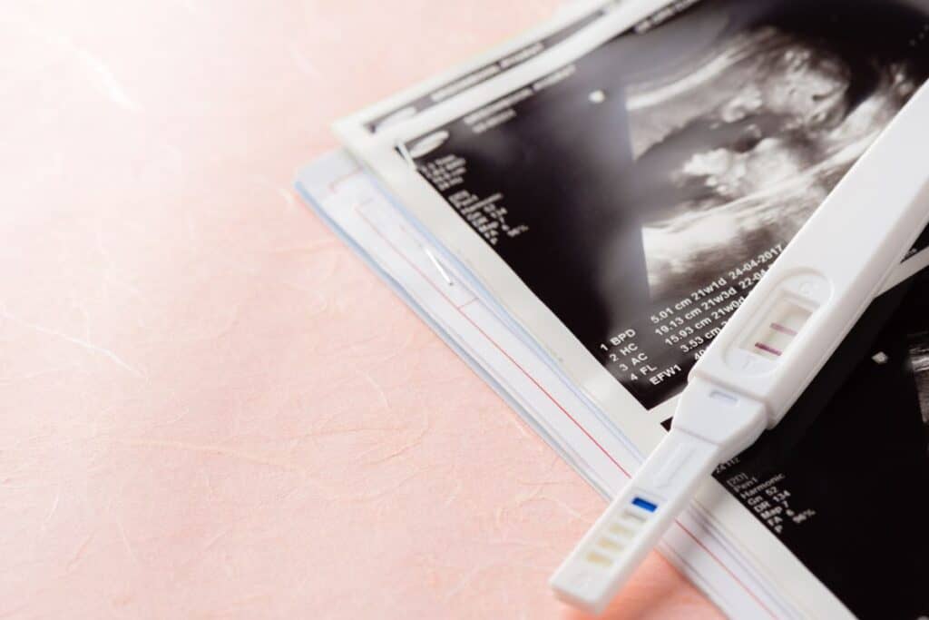 Black and white sonogram image with a positive pregnancy test lying on top.